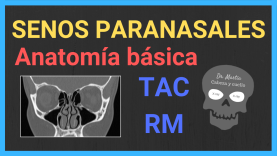 Senos paranasales anatomia radiologica