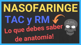 Nasofaringe-anatomia-tac-RM
