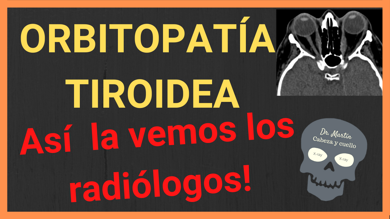 Orbitopatia tiroidea hallazgos radiologicos