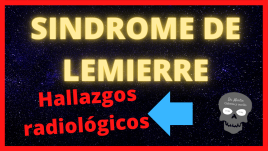 sindrome-de-lemierre-hallazgos-radiologicos